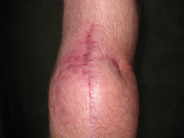 [IMG_1083%255B3%255D.jpg]
