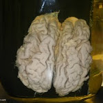 human_brain03.JPG