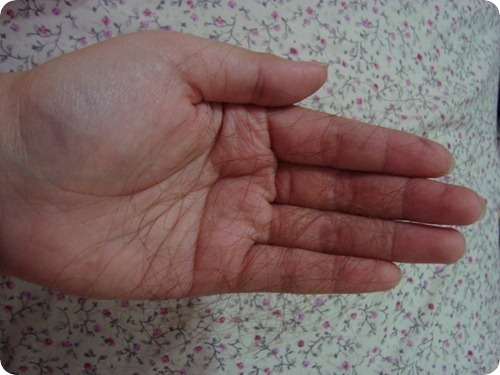 clip_image001