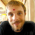 James' Bindi