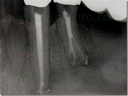 FIG N 40