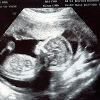 It's a girl!.jpg