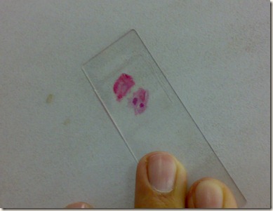 glass slide with tissue piece