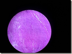 leiomyoma histology slide photo