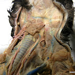 transverse_jugular.JPG