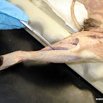 tibialis_anterior.JPG
