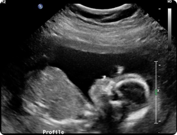 [HOLMQUISTCHASTITYA20110912194219840_thumb%255B9%255D%255B8%255D.jpg]