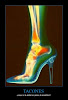¿Es malo usar tacones?