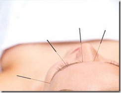 acupuntura curitiba paralisia facial