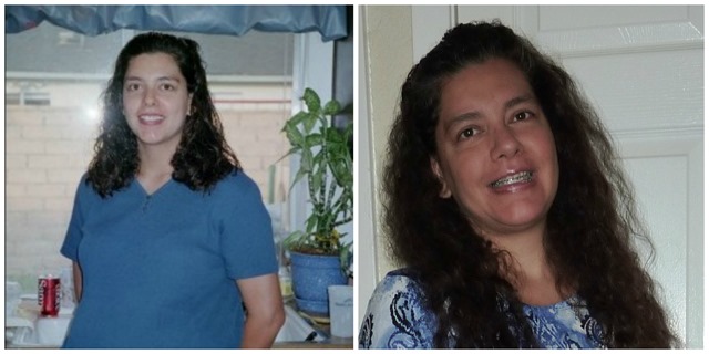 Before and Now Before and Now