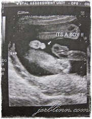 Scan