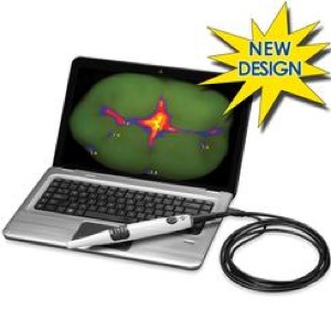 Spectra Caries Detection_2012.jpg