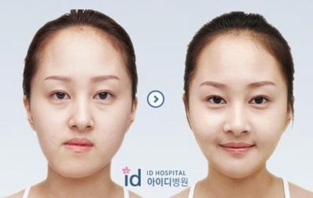 [korean-plastic-surgery-6%255B2%255D.jpg]