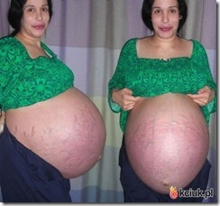 Ibu Lahirkan Bayi Kembar 11-Kezoom2