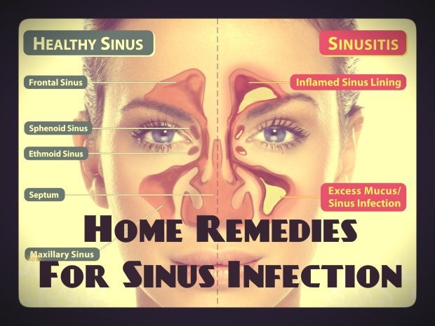 [sinus%255B4%255D.jpg]
