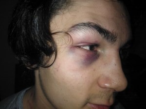 [Luan%2520Hoffmann%252001%255B3%255D.jpg]