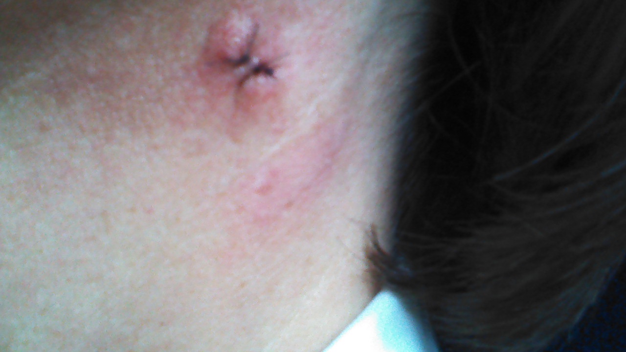 Health food stores edmonton ab, alberta health food safety course edmonton, rheumatoid arthritis