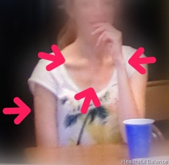 Anorexic to Fit Personal Picture 1