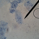 cheek02.jpg