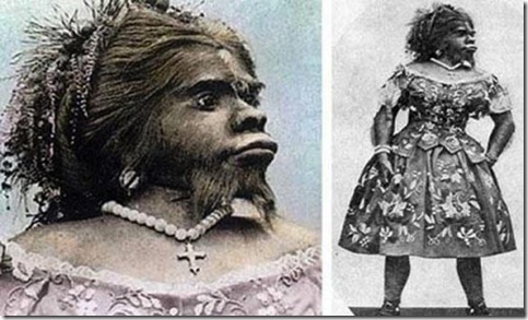 'Ape woman' buried after 150 years
