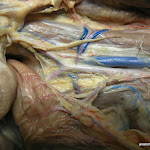 iliac.JPG