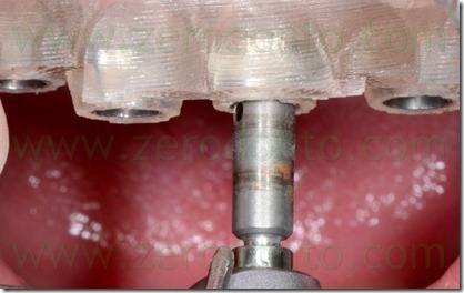 blog.071 blog.071