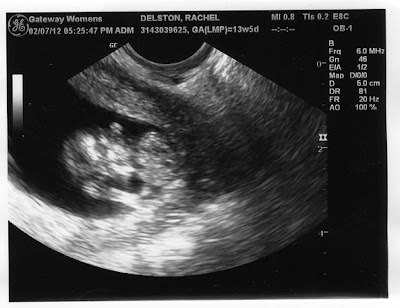 Due labor day!