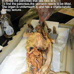 pancreas_large_L.JPG