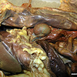 kidney.JPG