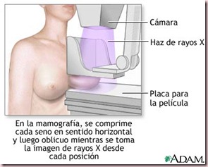 mamografia-esquema