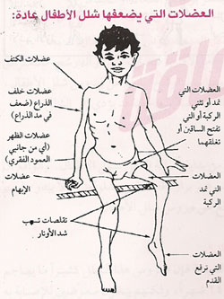 حملة تطعيم الاطفال ضد شلل الاطفال تشمل المواعيد والسن - اخبار وطني حملة تطعيم الاطفال ضد شلل الاطفال تشمل المواعيد والسن