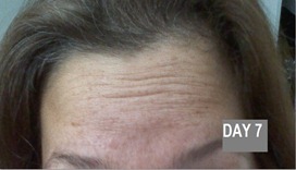 day7 day7