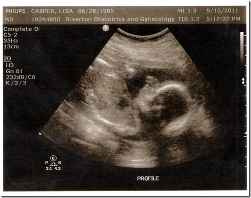 baby #3 profile