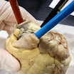 pulmonary_trunk.JPG