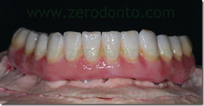 zirconia-ceramica