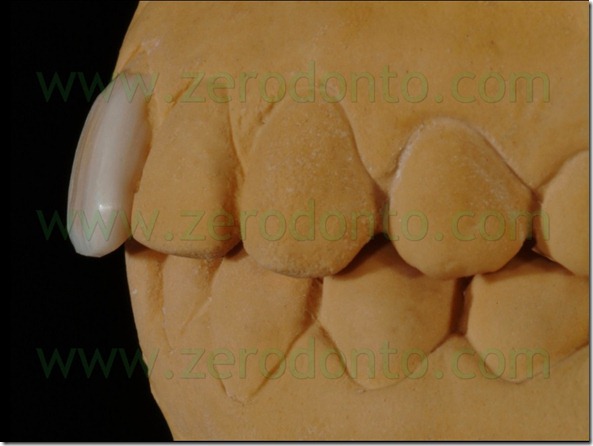 15 overbite