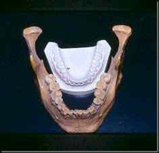 lovelock_dentes lovelock_dentes