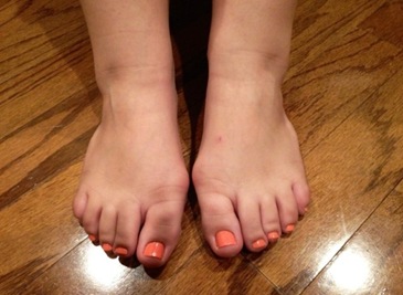 How-High-Heels-Ruined-My-Feet