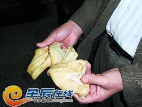 Tai lợn nghi là giả được phát hiện tại Tương Đàm, Hồ Bắc, Trung Quốc.