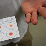 blood_test.JPG