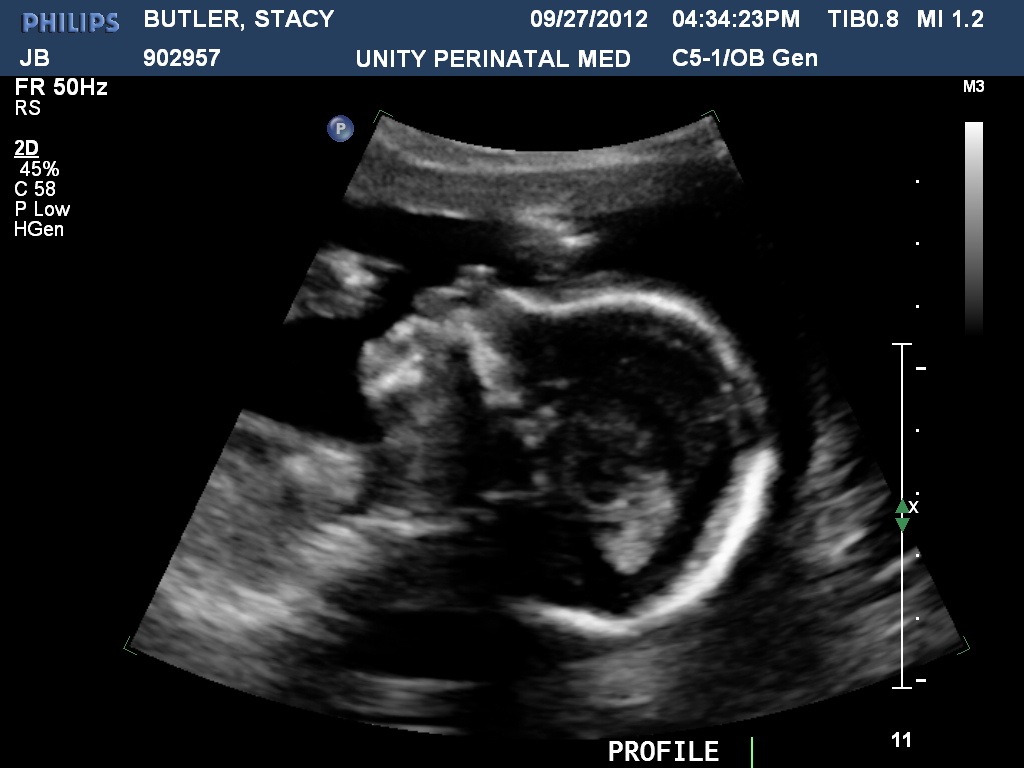 [BUTLERSTACY20120927163424082%255B2%255D.jpg]