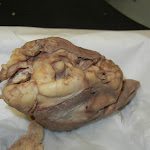 optic_nerve_02.JPG