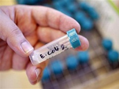 E.coli_