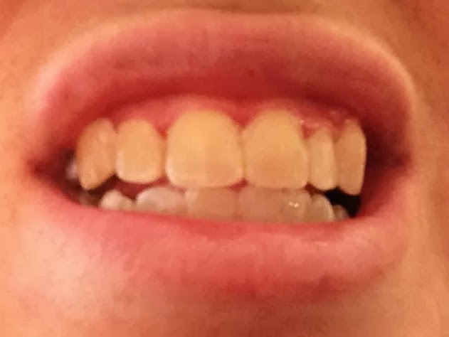 [teeth1%255B2%255D.jpg]