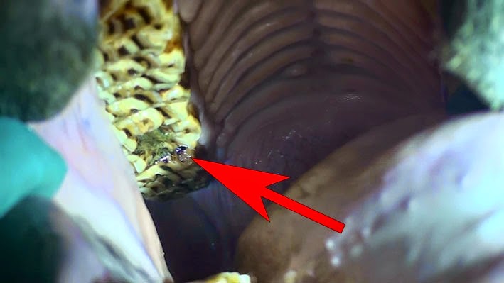 [20141114115034-%25281%2529%255B2%255D.jpg]