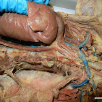 thoracic_aorta.JPG