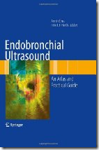 Endobronchial Ultrasound