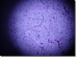 lipoma histology slide photograph
