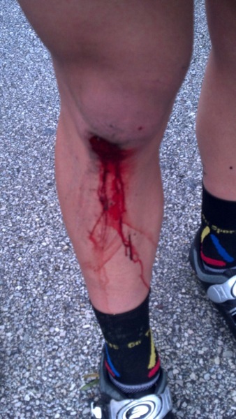 Konrad s Scraped Knee
