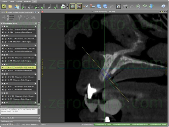 - (86) pin di stabilizzazione